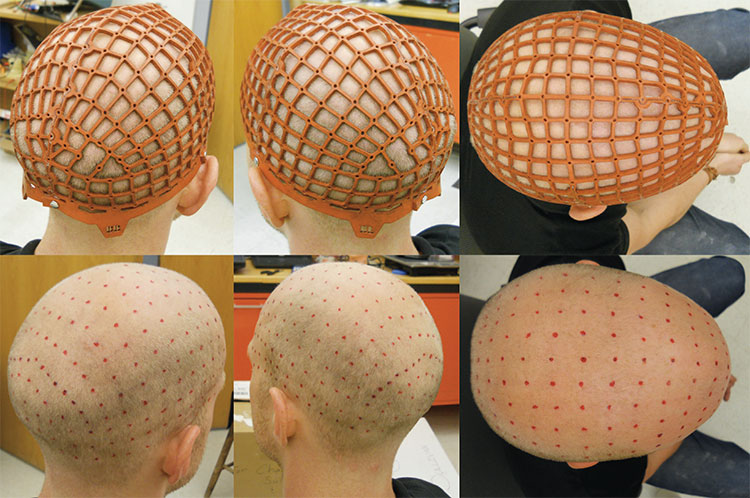 GiacoWeb used to mark 329 EEG electrode scalp coordinates on a male adult head.